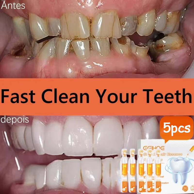 Teeth Whitening Baking Soda - Ripara rapidamente il siero delle gengive