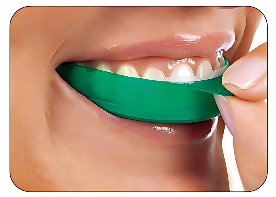 Teeth Whitening Opalescence Go - Strisce Sbiancanti per Denti Ultradent Opalescence