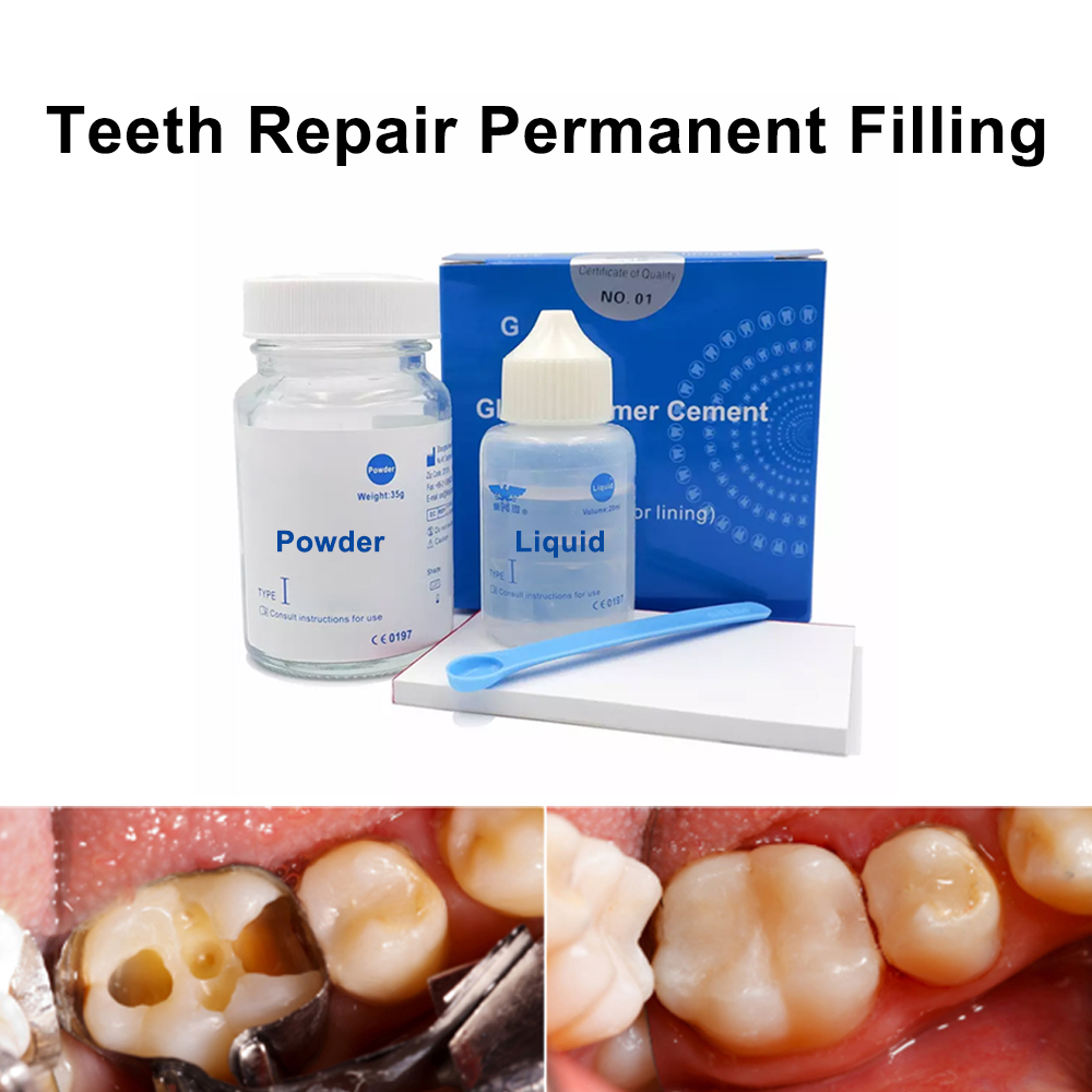 Teeth Whitening At Home Kit - Kit di riparazione per riempimento dentale