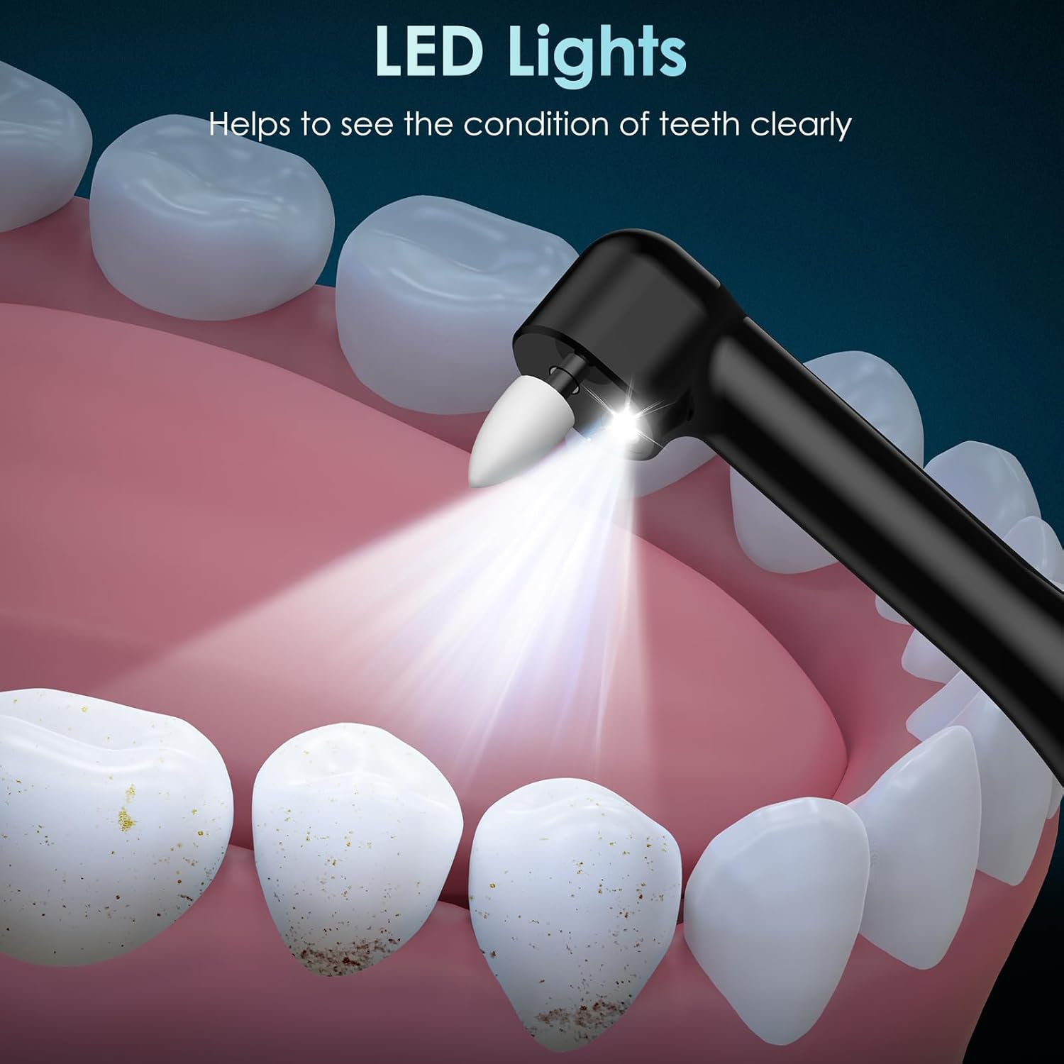 Lucidatore per denti Lucidator - Teeth Whitening Or Tooth Whitening recensione e prezzo