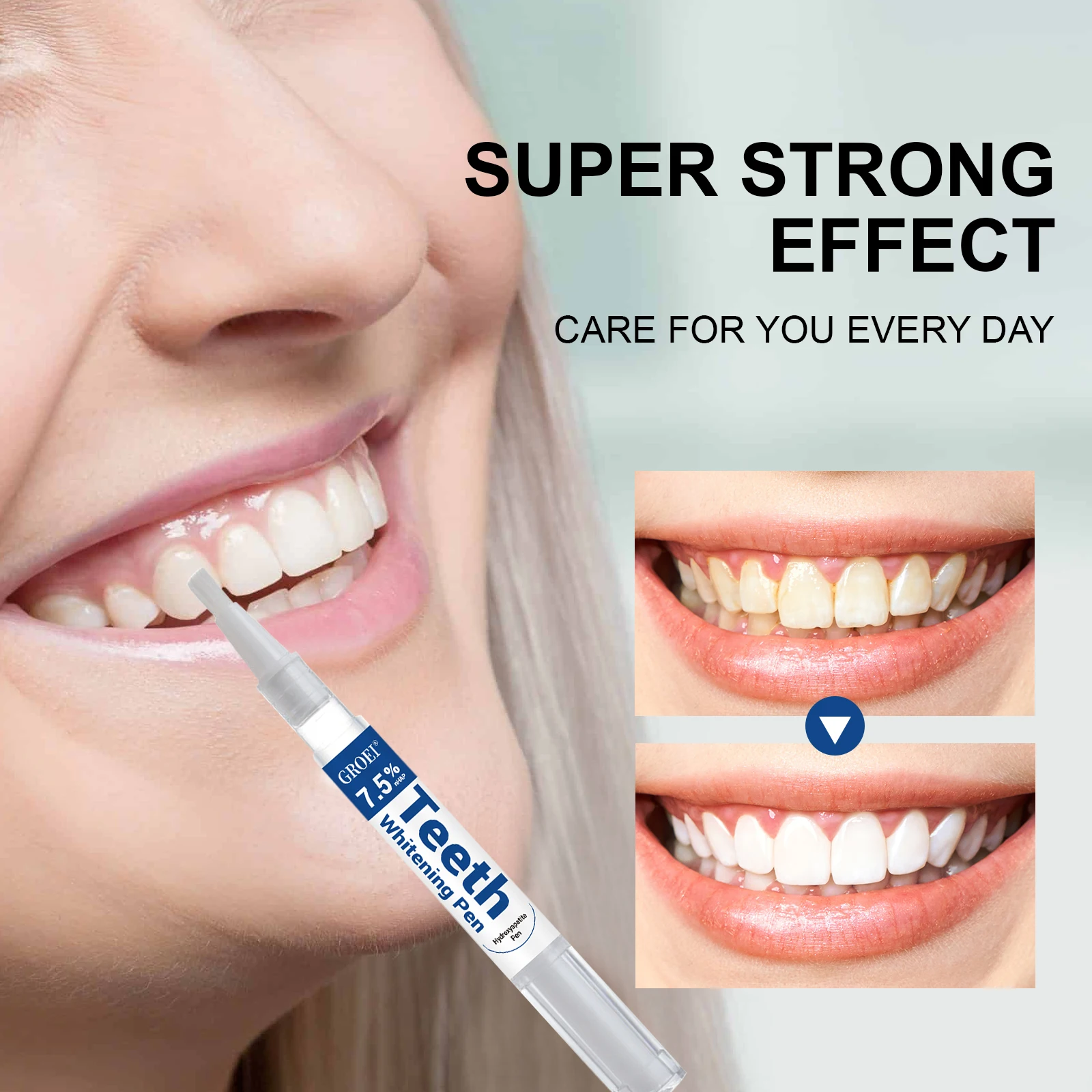 Penna per sbiancamento dei den - Teeth Whitening Pen recensione e prezzo