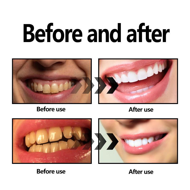 Polvere sbiancante per denti C - Teeth Whitening Baking Soda recensione e prezzo