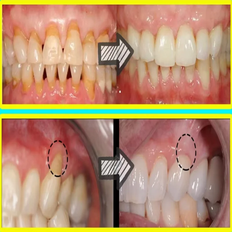 Ripara rapidamente il siero de - Teeth Whitening Baking Soda recensione e prezzo