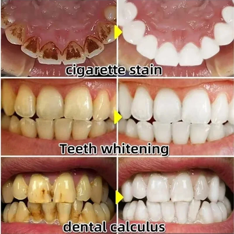Ripara rapidamente il siero de - Teeth Whitening Baking Soda recensione e prezzo