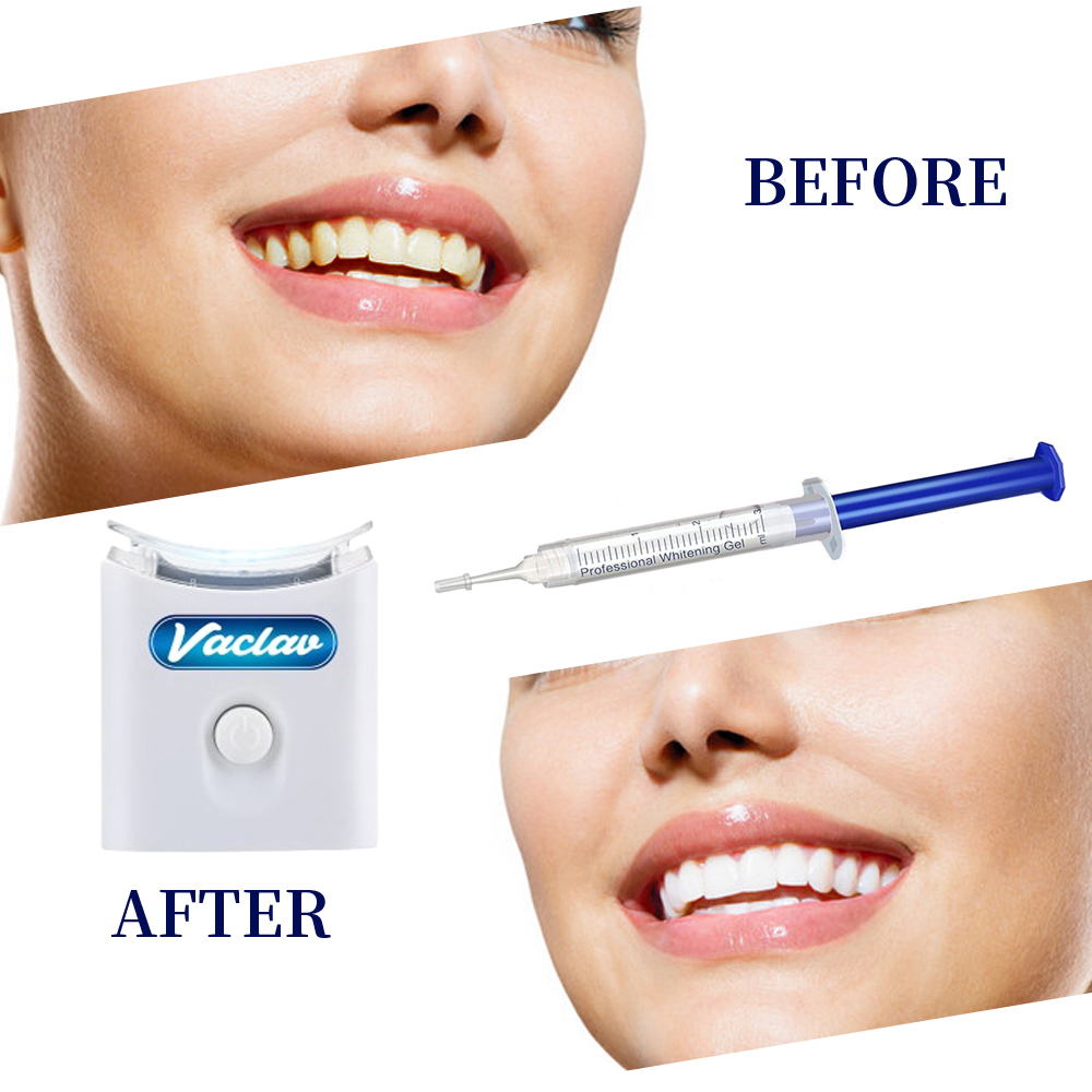 Menta Sbiancamento Dei Denti G - Teeth Whitening Baking Soda recensione e prezzo