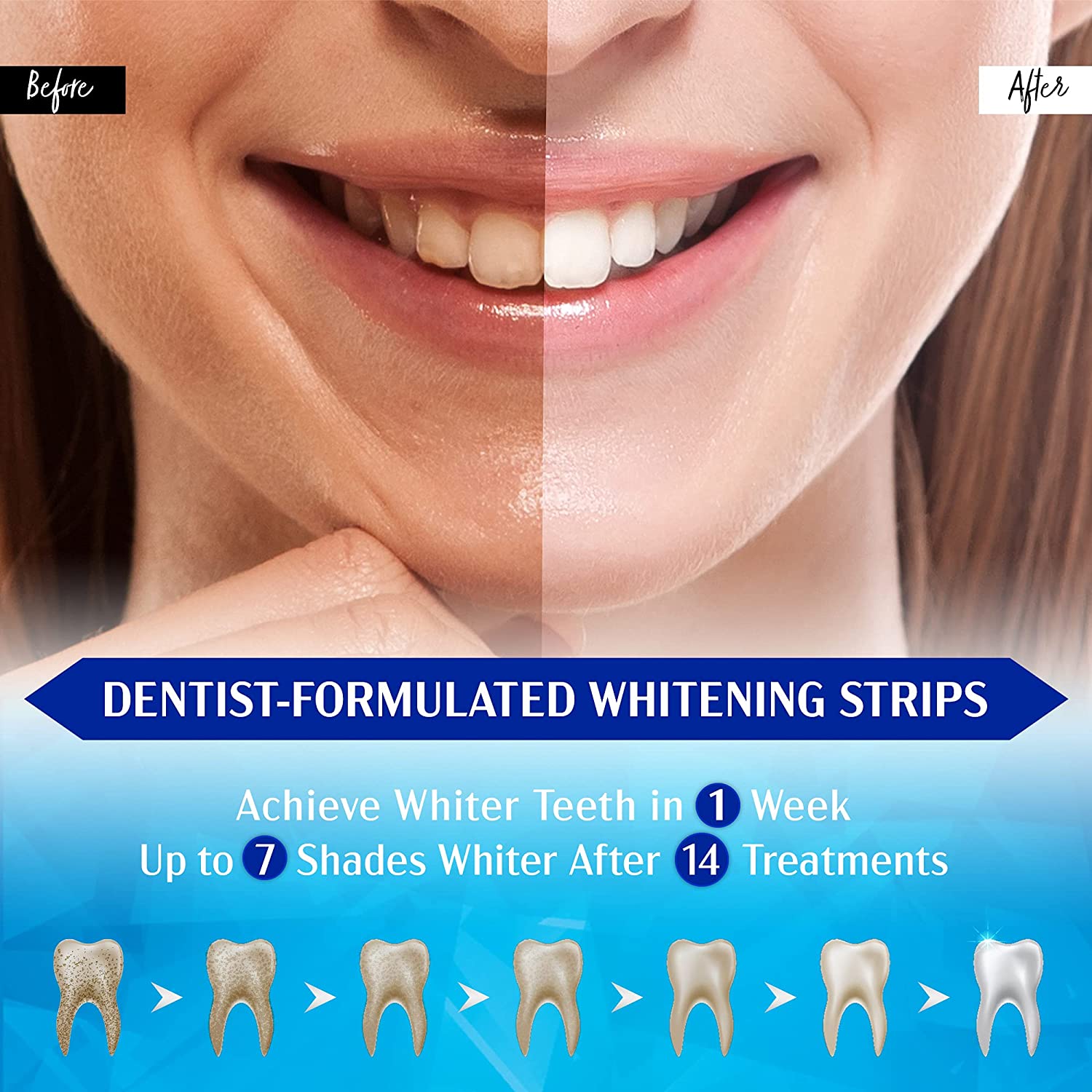 Set di 28 Strisce Sbiancanti P - Whitening Strip 3D recensione e prezzo