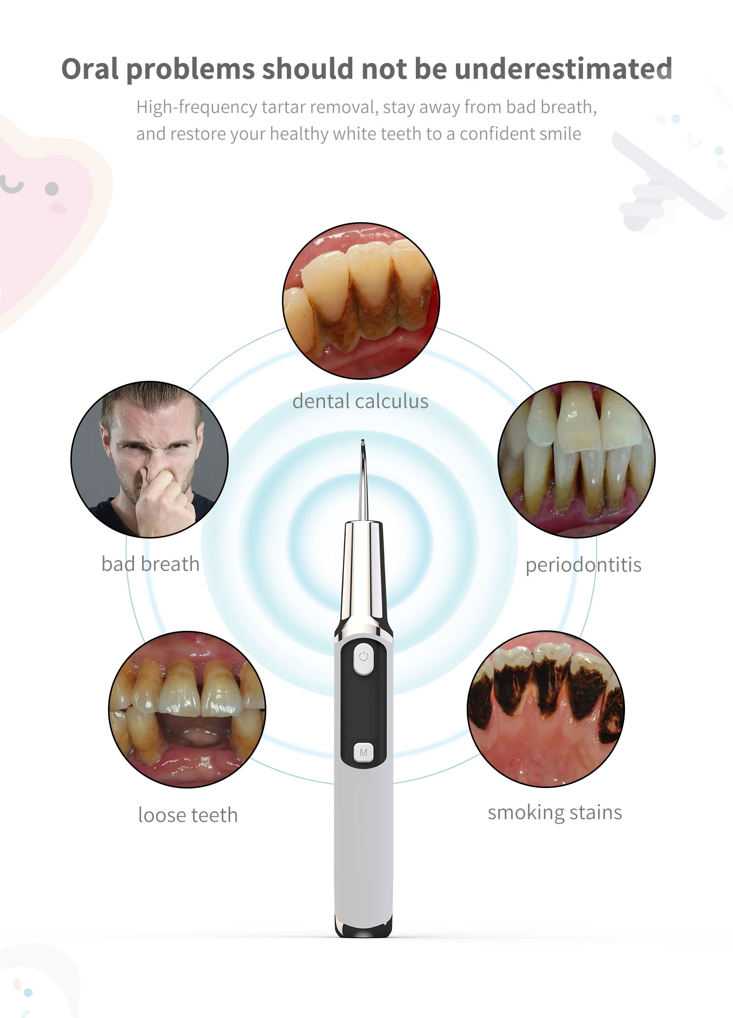 Elettrico Sonic Calcolo Dental - Teeth Whitening Or Tooth Whitening recensione e prezzo