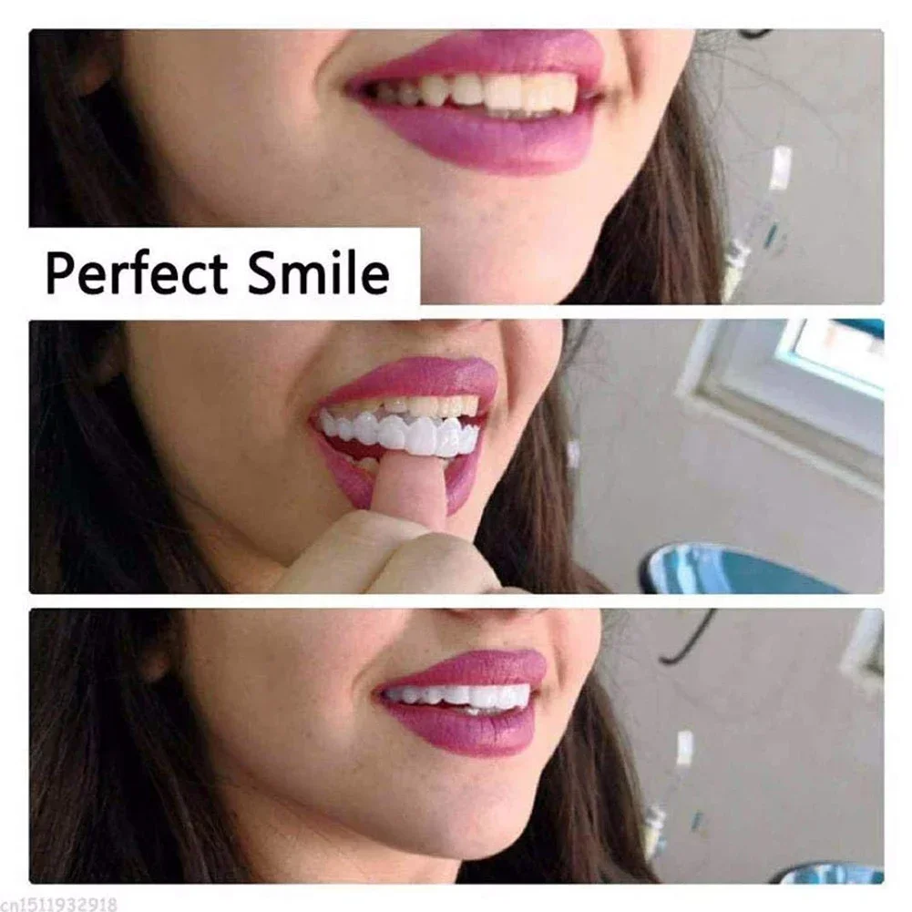 Faccette Dentali Riutilizzabil - Teeth Whitening For Photos recensione e prezzo