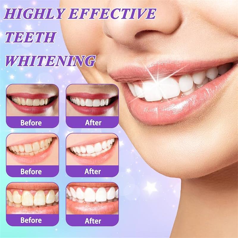 Dentifricio sbiancante 9D viol - Teeth Whitening Naturally recensione e prezzo
