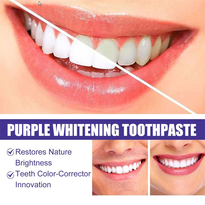 Dentifricio sbiancante 9D viol - Teeth Whitening Naturally recensione e prezzo