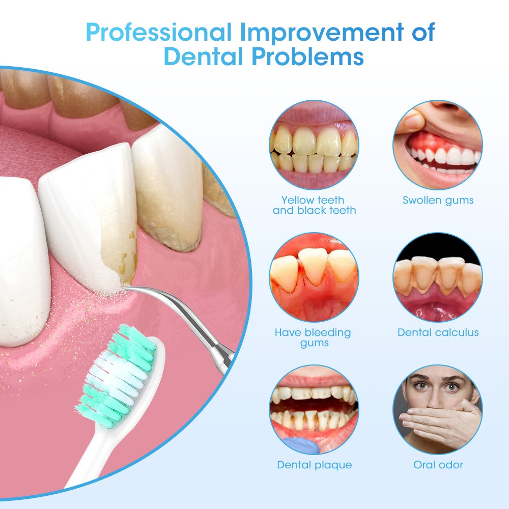 LC-H156X Elettrico Sbiancament - Teeth Whitening And Stain Removal recensione e prezzo
