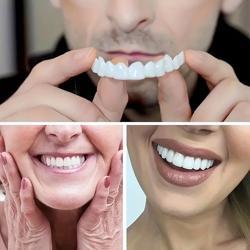 Faccette Dentali Speciali per  - Teeth Whitening For Photos recensione e prezzo