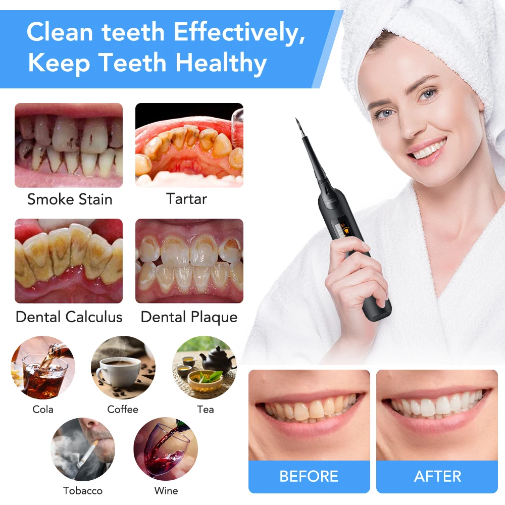 Elettrico Dentale Scaler Spazz - Teeth Whitening Or Tooth Whitening recensione e prezzo