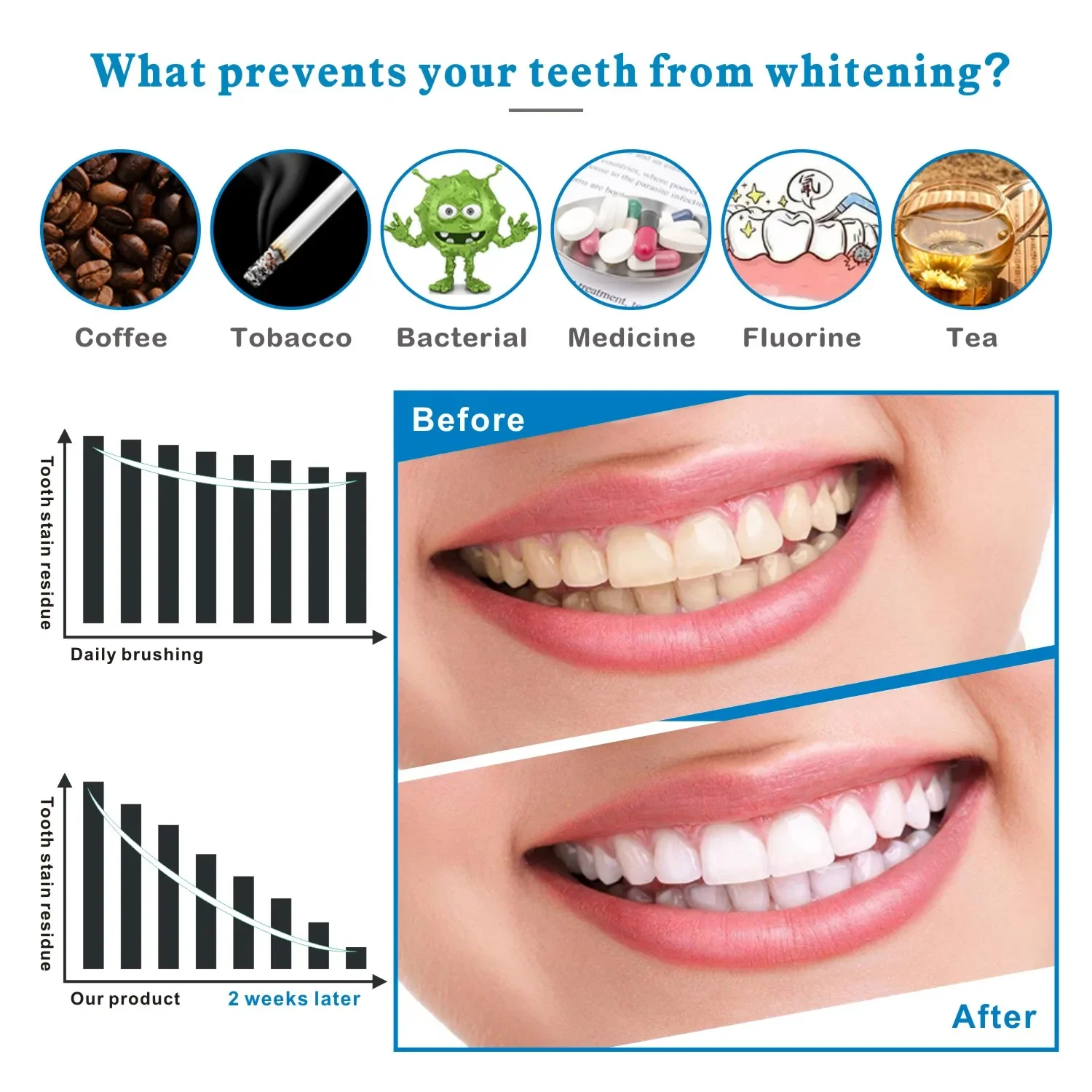 14/28pcs 3D Strisce Sbiancanti - Whitening Strip 3D recensione e prezzo