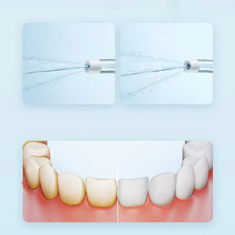 Irrigatore Orale Portatile Xia - Teeth Whitening Or Tooth Whitening recensione e prezzo