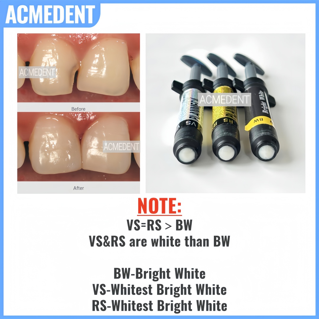 4.5g Dentale Composito Impiall - Teeth Whitening Vs Veneers recensione e prezzo