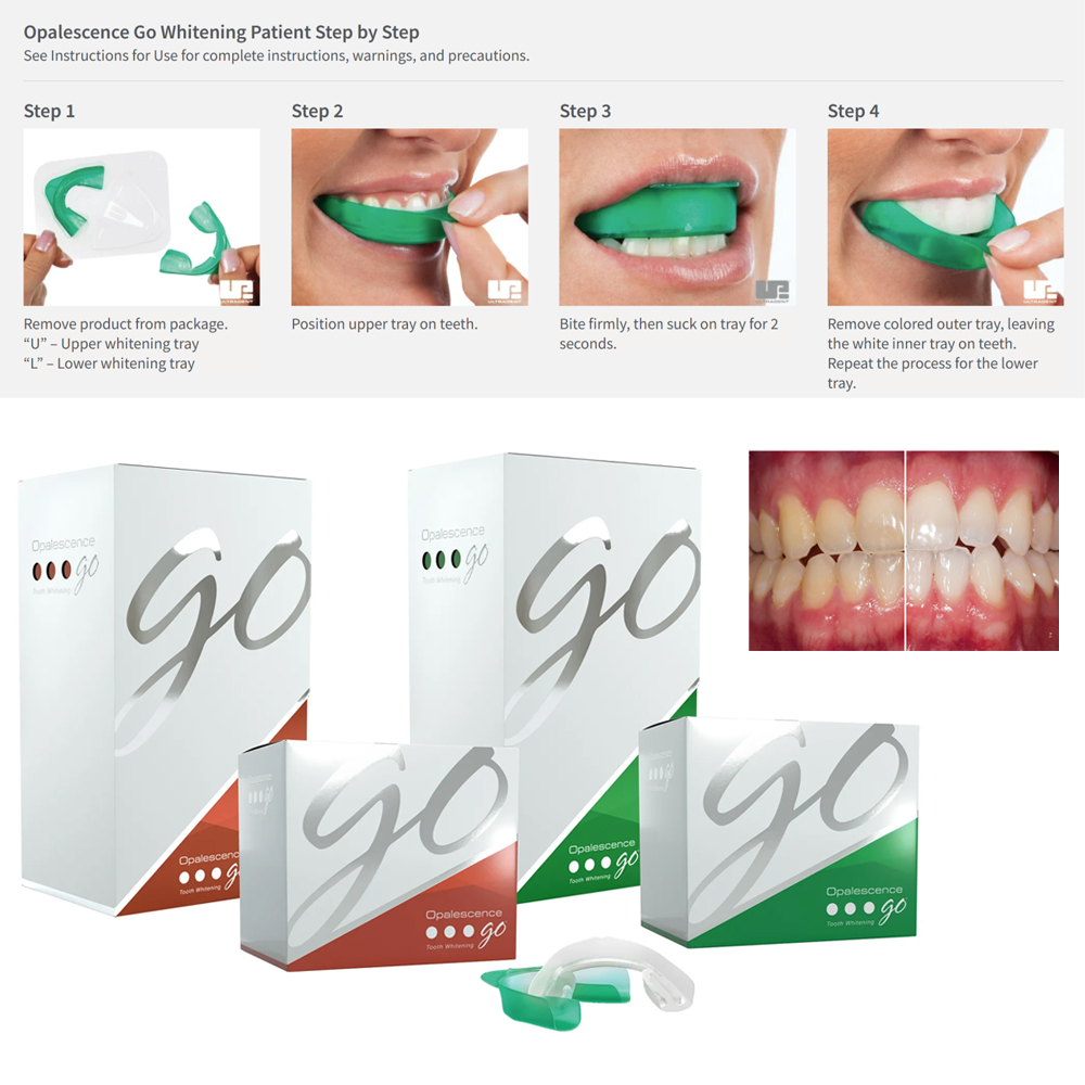 Opalescence Go vassoi sbiancan - Teeth Whitening Opalescence Go recensione e prezzo