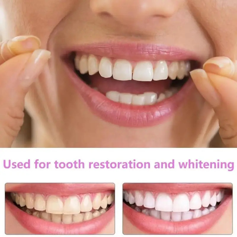 Nuove Faccette Dentali Riutili - Teeth Whitening For Photos recensione e prezzo