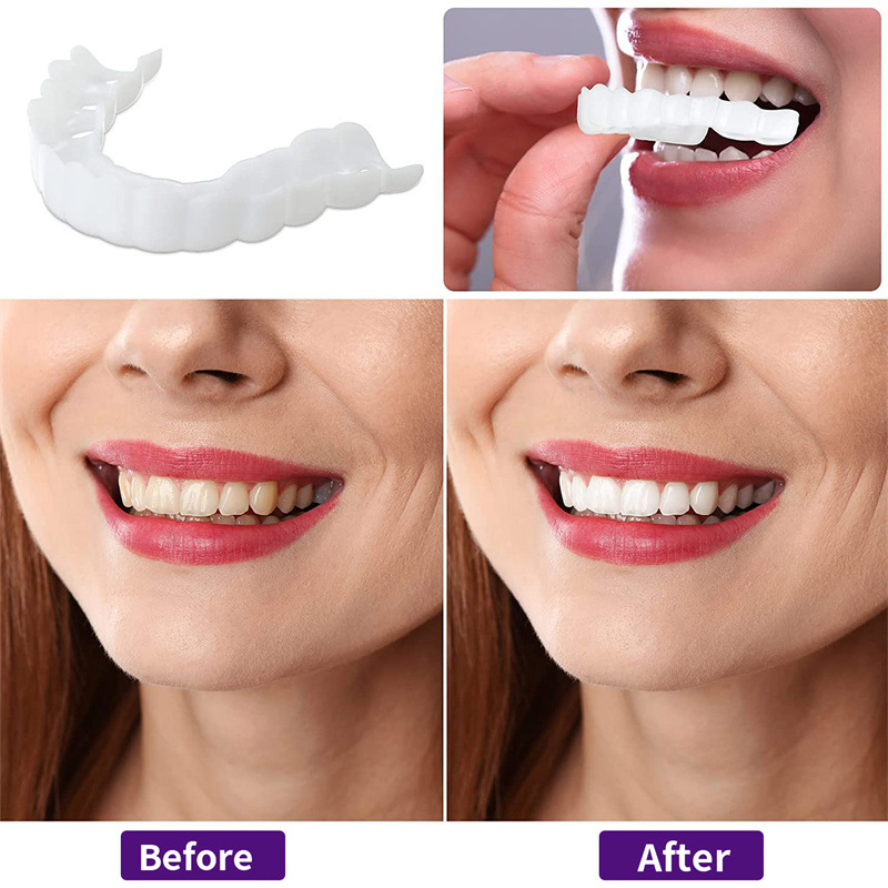 Nuove Faccette Dentali Riutili - Teeth Whitening For Photos recensione e prezzo