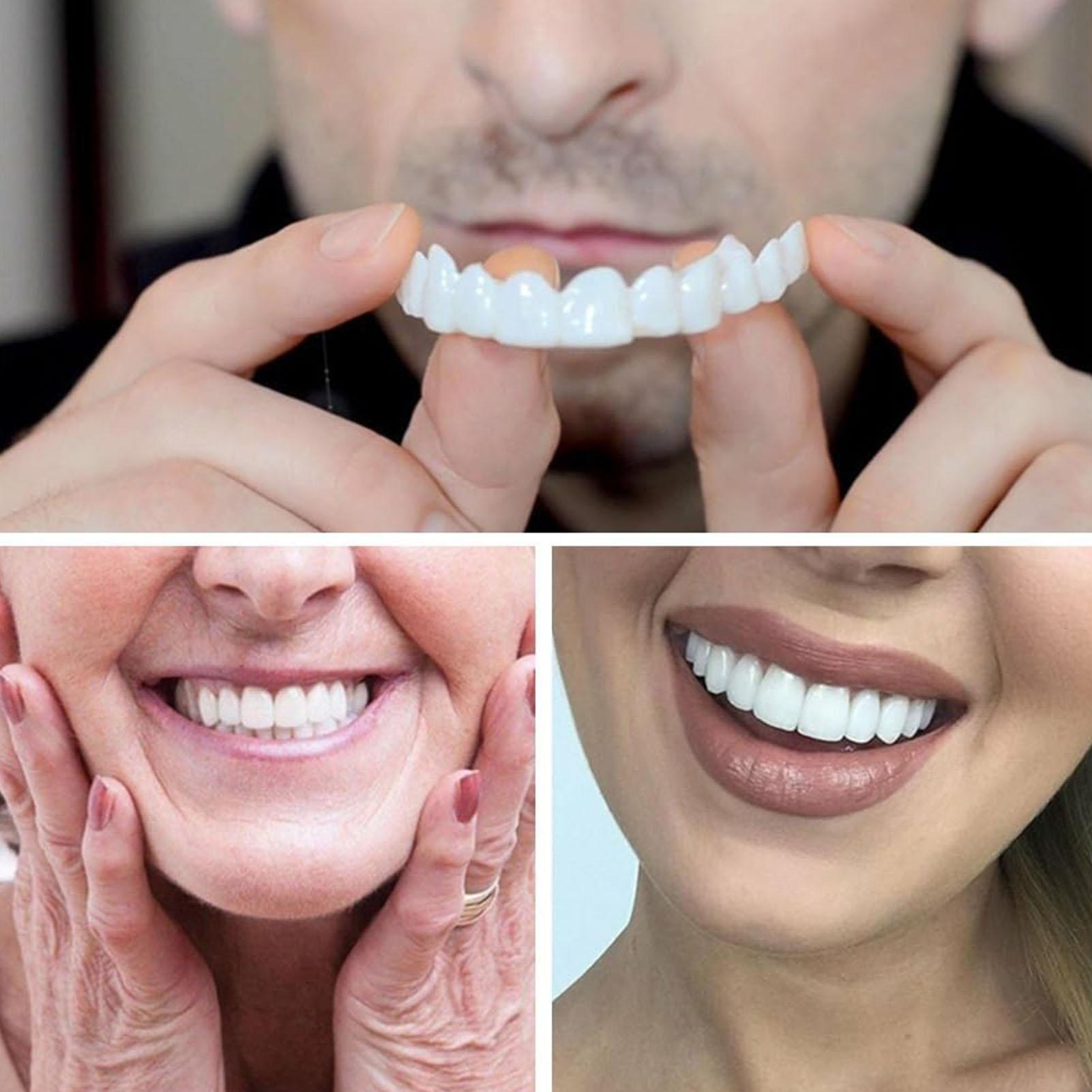 Nuova Mascherina per Denti Eff - Teeth Whitening For Photos recensione e prezzo