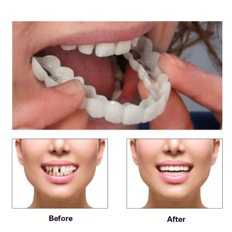 Nuove Faccette Dentali Riutili - Teeth Whitening For Photos recensione e prezzo