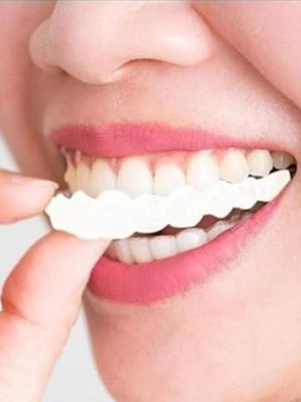Faccette Dentali Riutilizzabil - Teeth Whitening For Photos recensione e prezzo