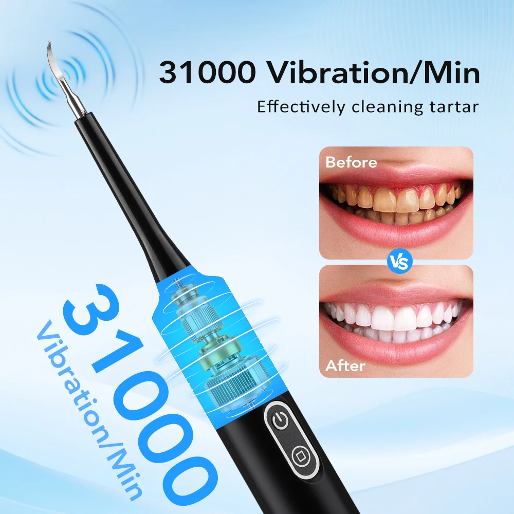 Scalatore Dentale Elettrico a  - Electric Toothbrush Sonic recensione e prezzo