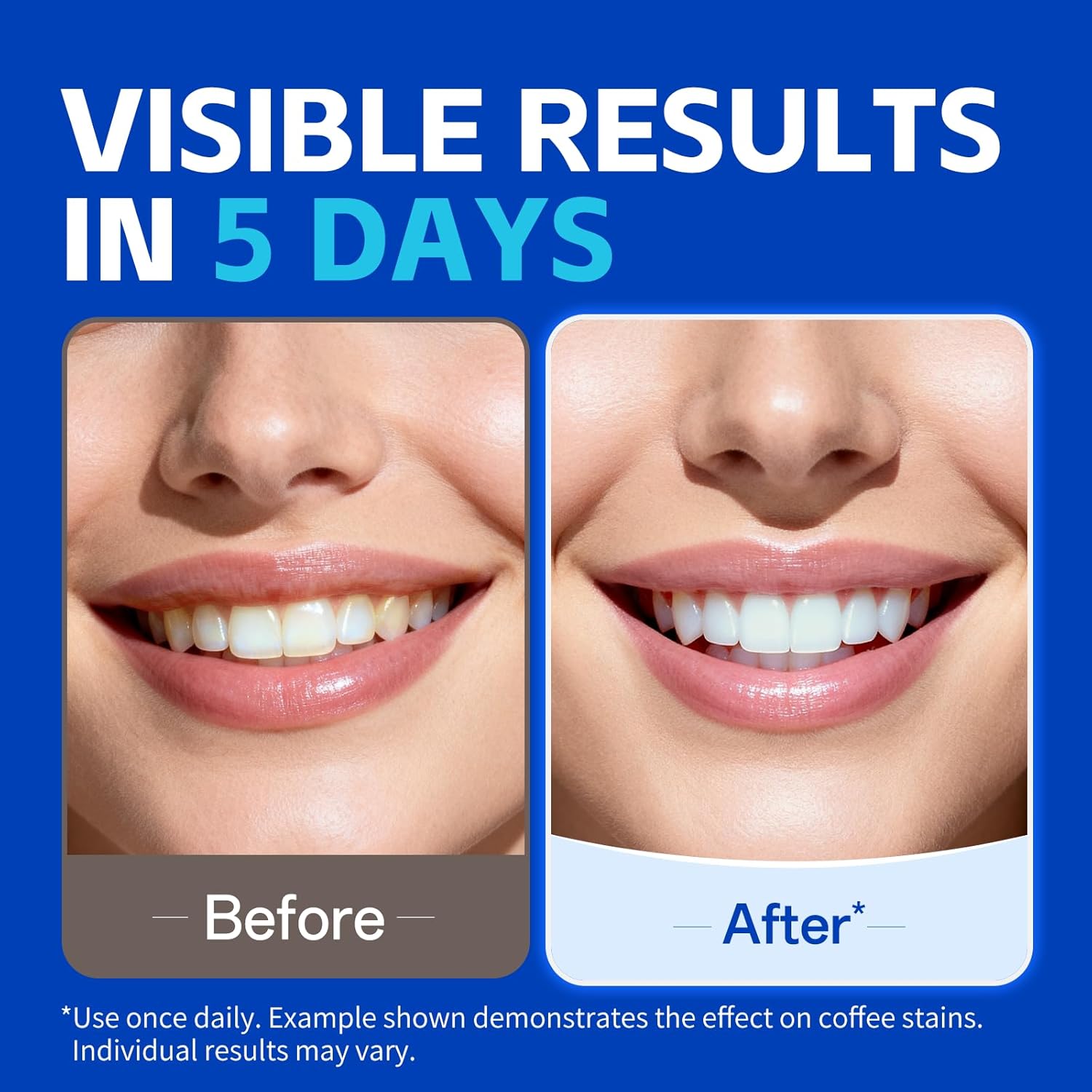 Strisce sbiancanti per denti K - Teeth Whitening Oil Pulling recensione e prezzo