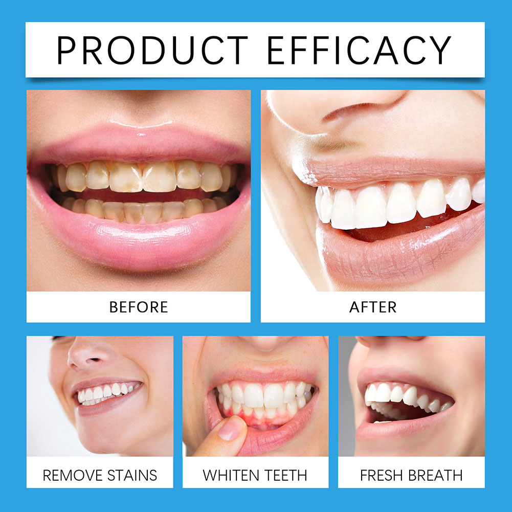 Polvere professionale per la r - Teeth Whitening For Photos recensione e prezzo